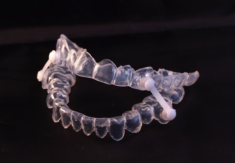 oral appliance